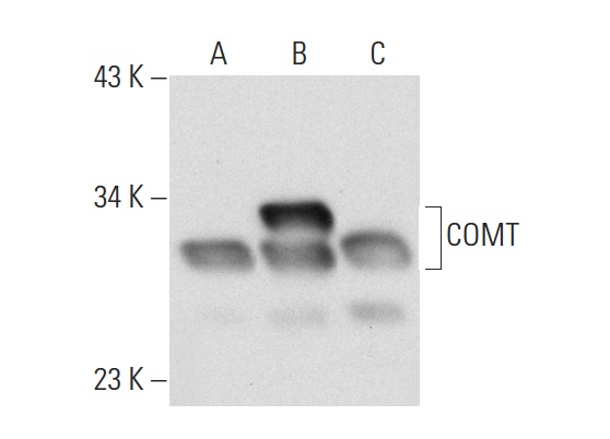 COMT (FL-271): sc-25844. Western blot analysis of COMT expression in non-transfected 293T: sc-117752 (A), human COMT transfected 293T: sc-128345 (B) and JAR (C) whole cell lysates.