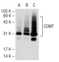 COMT (FL-271): sc-25844. Western blot analysis of COMT expression in non-transfected 293T: sc-117752 (A), human COMT transfected 293T: sc-128346 (B) and K-562 (C) whole cell lysates.