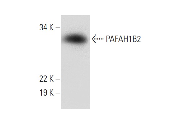PAFAH1B2 (A-6): sc-393216. Western blot analysis of PAFAH1B2 expression in human liver tissue extract.