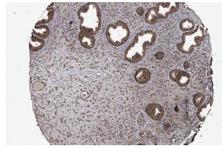 CRYZL1 (C-20): sc-83233. Immunoperoxidase staining of formalin fixed, paraffin-embedded human prostate showing nuclear and cytoplasmic staining of glandular cells at low magnification. Kindly provided by The Swedish Human Protein Atlas (HPA) program.