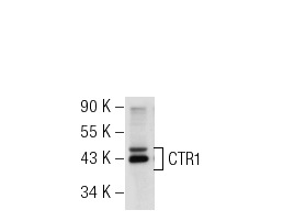 CTR1 (FL-190): sc-66847. Western blot analysis of CTR1 expression in Hela whole cell lysate.