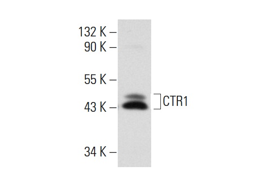 CTR1 (FL-190): sc-66847. Western blot analysis of CTR1 expression Hela whole cell lysate.