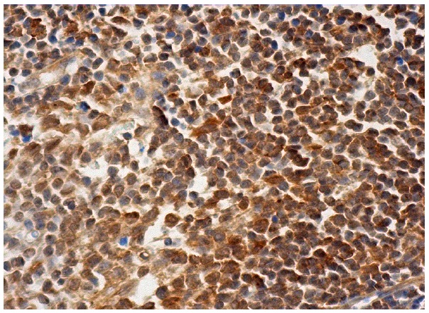 CTR1 (FL-190): sc-66847. Immunoperoxidase staining of formalin fixed, paraffin-embedded human lymph node tissue showing cytoplasmic staining of cells in germinal and non-germinal centers.