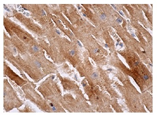 CTR1 (FL-190): sc-66847. Immunoperoxidase staining of formalin fixed, paraffin-embedded human heart muscle tissue showing cytoplasmic staining of myocytes.