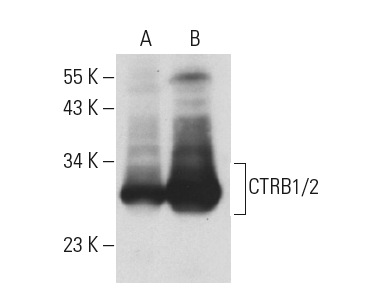 CTRB1/2 (F-13): sc-161496. Western blot analysis of CTRB1/2 expression in M1 whole cell lysate (A) and mouse pancreas tissue extract (B).