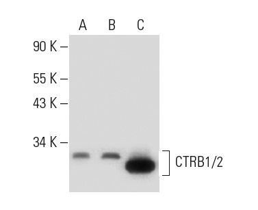 CTRB1/2 (F-13): sc-161496. Western blot analysis of CTRB1/2 expression in NIH/3T3 (A) and c4 (B) whole cell lysates and mouse pancreas tissue extract (C).