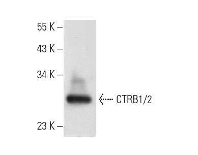 CTRB1/2 (F-13): sc-161496. Western blot analysis of CTRB1/2 expression in human pancreas tissue extract.