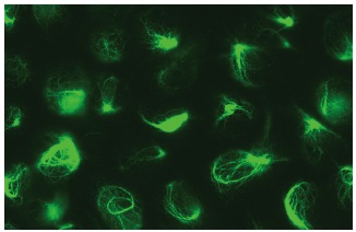 CXXC5 (S-12): sc-135467. Immunofluorescence staining of methanol-fixed HeLa cells showing perinuclear localization.