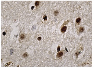 CXXC5 (S-12): sc-135467. Immunoperoxidase staining of formalin fixed, paraffin-embedded human brain tissue showing nuclear staining of neuronal and glial cells.