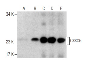 CXXC5 (S-12): sc-135467. Western blot analysis of CXXC5 expression in non-transfected: sc-110760 (A) and human CXXC5 transfected: sc-173695 (B) 293 whole cell lysates and HeLa (C), MCF7 (D) and K-562 (E) nuclear extracts.