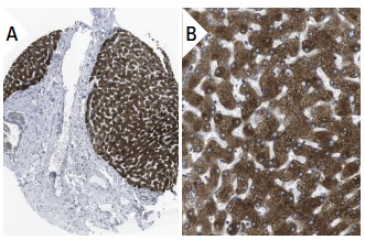 CYP1A2 (3B8C1): sc-53614. Immunoperoxidase staining of formalin fixed, paraffin-embedded human liver tissue showing cytoplasmic staining in hepatocytes and bile duct cells (low and high magnification). Kindly provided by The Swedish Human Protein Atlas (HPA) program.