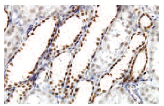 DcpS (H4-32): sc-130451. Immunoperoxidase staining of formalin-fixed, paraffin-embedded human kidney tissue showing nuclear and cytoplasmic localization.