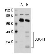 DDAH II (H-85): sc-32859. Western blot analysis of DDAH II expression in non-transfected: sc-117752 (A) and mouse DDAH II transfected: sc-119697 (B) 293T whole cell lysates.