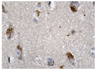 DDAH II (H-85): sc-32859. Immunoperoxidase staining of formalin fixed, paraffin-embedded human brain tissue showing cytoplasmic staining of neuronal cells.