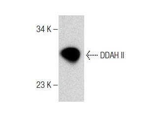 DDAH II (H-85): sc-32859. Western blot analysis of DDAH II expression in mouse small intestines tissue extract.