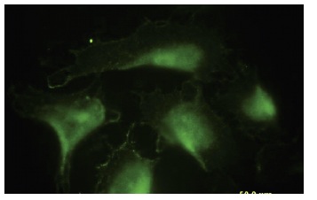 DnaJA4 (LL2): sc-100714. Immunofluorescence staining of paraformaldehyde-fixed HeLa cells showing membrane and cytoplasmic localization.