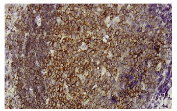 DnaJA4 (LL2): sc-100714. Immunoperoxidase staining of formalin-fixed, paraffin-embedded human tonsil tissue showing membrane localization.