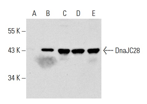 DnaJC28 (S-20): sc-83545. Western blot analysis of DnaJC28 expression in non-transfected 293T: sc-117752 (A), human DnaJC28 transfected 293T: sc-175769 (B), MES-SA/Dx5 (C) and Hep G2 (D) whole cell lysates and mouse brain tissue extract (E).