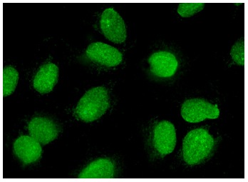 DnaJC28 (S-20): sc-83545. Immunofluorescence staining of formalin-fixed Hep G2 cells showing nuclear localization.