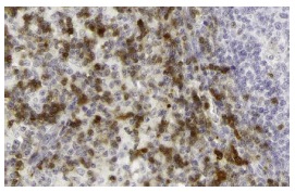 Dok-2 (E-10): sc-17830. Immunoperoxidase staining of formalin fixed, paraffin-embedded human lymph node tissue showing nuclear staining of paracortex cells. Kindly provided by The Swedish Human Protein Atlas (HPA) program.