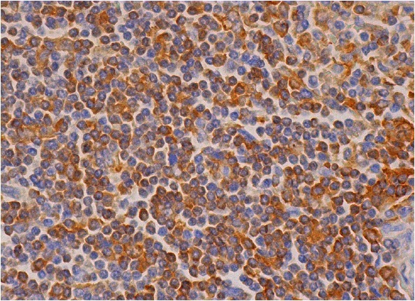 Dok-2 (E-10): sc-17830. Immunoperoxidase staining of formalin fixed, paraffin-embedded human spleen tissue showing cytoplasmic staining of cells in white pulp and cells in red pulp.