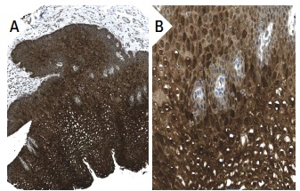 IL-1ra (H-110): sc-25444. Immunoperoxidase staining of formalin fixed, paraffin-embedded human esophagus tissue showing cytoplasmic staining of squamous epithelial cells at low (A) and high (B) magnification. Kindly provided by The Swedish Human Protein Atlas (HPA) program.