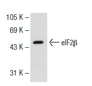 eIF2β (C-1): sc-133133. Western blot analysis of eIF2β expression in 293T whole cell lysate.