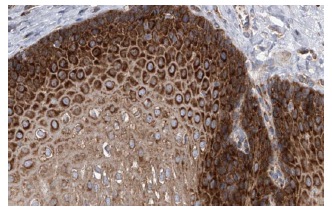 eIF2β (C-1): sc-133133. Immunoperoxidase staining of formalin-fixed, paraffin-embedded human esophagus tissue showing cytoplasmic staining of squamous epithelial cells. Kindly provided by The Swedish Human Protein Atlas (HPA) program.