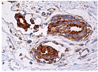 eIF2β (C-1): sc-133133. Immunoperoxidase staining of formalin fixed, paraffin-embedded human breast tissue showing cytoplasmic staining of glandular cells.