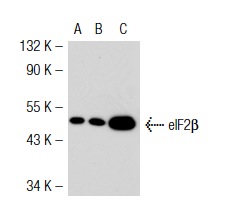 eIF2β (P-3): sc-9978. Western blot analysis of eIF2β expression in non-transfected 293T: sc-117752 (A), mouse eIF2β transfected 293T: sc-126775 (B) and KNRK (C) whole cell lysates.