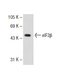 eIF2β (P-3): sc-9978. Western blot analysis of eIF2β expression in 293T whole cell lysate.