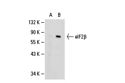 eIF2b (P-3): sc-9978. Western blot analysis of eIF2b expression in non-transfected: sc-110760 (A) and human eIF2b transfected: sc-110792 (B) 293 whole cell lysates.