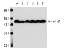 eIF2b (P-3): sc-9978. Western blot analysis of eIF2b expression in non-transfected: sc-110760 (A) and human eIF2b transfected: sc-110792 (B) 293 whole cell lysates.