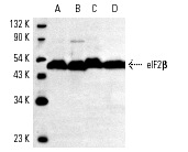 eIF2β (P-3): sc-9978. Western blot analysis of eIF2β expression in KNRK (A), NIH/3T3 (B), A-431 (C) and K-562 (D) whole cell lysates.