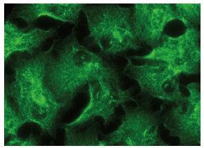 eIF3θ (E-1): sc-365789. Immunofluorescence staining of methanol-fixed HeLa cells showing cytoplasmic and membrane localization.