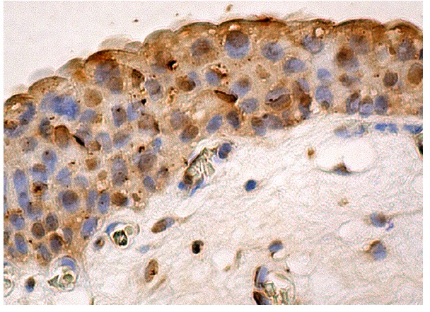 eIF3θ (E-1): sc-365789. Immunoperoxidase staining of formalin fixed, paraffin-embedded human urinary bladder tissue showing cytoplasmic and nuclear staining of squamous epithelial cells.
