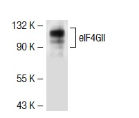 eIF4GII (R16S): sc-100732. Western blot analysis of eIF4GII expression in MCF7 whole cell lysate.