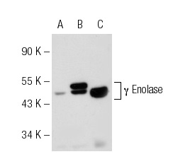 γ Enolase (NSE-P2): sc-21737. Western blot analysis of γ Enolase expression in non-transfected 293T: sc-117752 (A), human γ Enolase transfected 293T: sc-170262 (B) and Y79 (C) whole cell lysates.