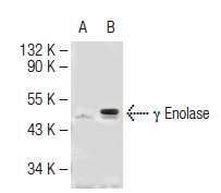 γ Enolase (NSE-P2): sc-21737. Western blot analysis of γ Enolase expression in non-transfected: sc-117752 (A) and human γ Enolase transfected: sc-170729 (B) 293T whole cell lysates.
