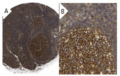 Eps15 (C-20): sc-534. Immunoperoxidase staining of formalin fixed, paraffin-embedded human lymph node tissue showing cytoplasmic and membrane staining of follicle and non-follicle cells at low (A) and high (B) magnification. Kindly provided by The Swedish Human Protein Atlas (HPA) program.