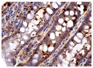 epsin 1 (F-7): sc-55555. Immunoperoxidase staining of formalin fixed, paraffin-embedded human rectum tissue showing cytoplasmic staining of glandular cells.