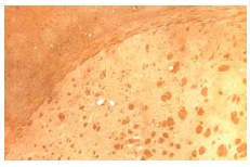 Met/Leu-enkephalin (NOC1/35): sc-47705. Immunoperoxidase staining of formalin-fixed, paraffin-embedded rat brain tissue showing Enkephalin positivecells inthe Ventral Lateral Striatum.Image kindly provided by Regina Vontell, Adrienne Betz and John Salamone, University of Connecticut
