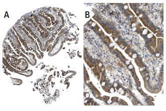 Met/Leu-enkephalin (NOC1/35): sc-47705. Immunoperoxidase staining of formalin fixed, paraffin-embedded human duodenum tissue showing cytoplasmic staining of glandular cells (low and high magnification). Kindly provided by The Swedish Human Protein Atlas (HPA) program.