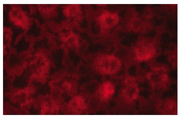 EWS (G-5): sc-28327. Immunofluorescence staining of methanol-fixed HeLa cells showing nuclear and cytoplasmic localization.