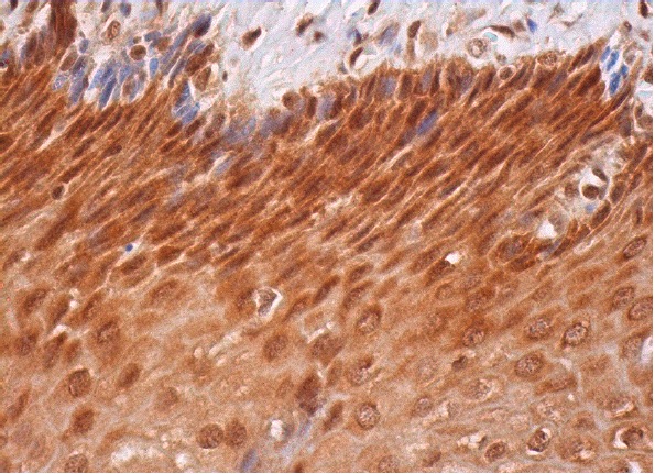 EWS (H-60): sc-28865. Immunoperoxidase staining of formalin fixed, paraffin-embedded human esophagus tissue showing nuclear and cytoplasmic staining of squamous epithelial cells.