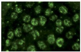 EWS (C-9): sc-48404. Immunofluorescence staining of methanol-fixed HeLa cells showing nuclear localization.