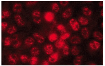 EWS (C-9): sc-48404. Immunofluorescence staining of methanol-fixed HeLa cells showing nuclear localization.