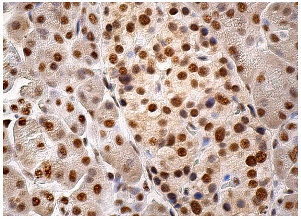 EWS (C-9): sc-48404. Immunoperoxidase staining of formalin fixed, paraffin-embedded human pancreas tissue showing nuclear staining of Islets of Langerhans and glandular cells.