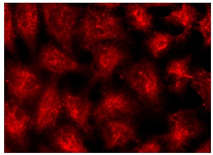 mouse anti-goat IgG-R: sc-2490. Immunofluorescence staining of methanol-fixed HeLa cells showing cytoplasmic localization. Antibody tested: Exo84 (C-16): sc-160319.
