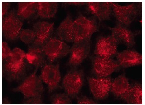 rabbit anti-goat IgG-PE: sc-3755. Immunofluorescence staining of methanol-fixed HeLa cells showing cytoplasmic localization. Antibody tested: Exo84 (C-16): sc-160319.